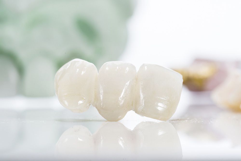 Dental restoration