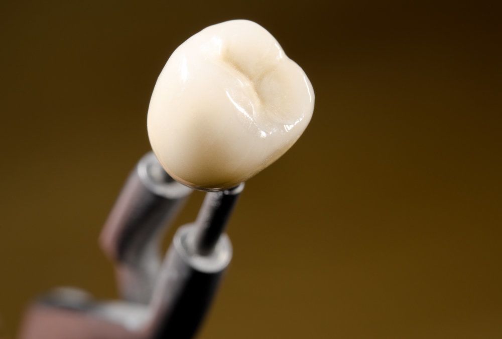 An older couple laughs together after receiving dental crowns